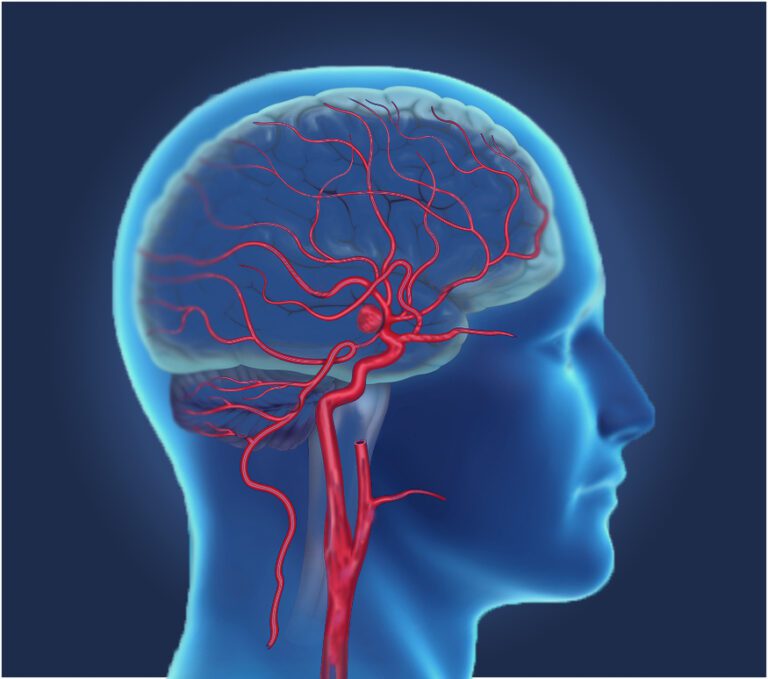 Best Neurosurgeon In Solapur | Neurointerventional Surgery